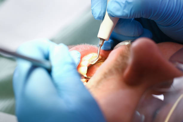 Best Weekend Emergency Dental Services in Monterey, TN