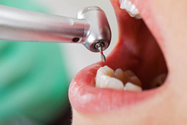 Best Emergency Dental Care for Sports Injuries in Monterey, TN